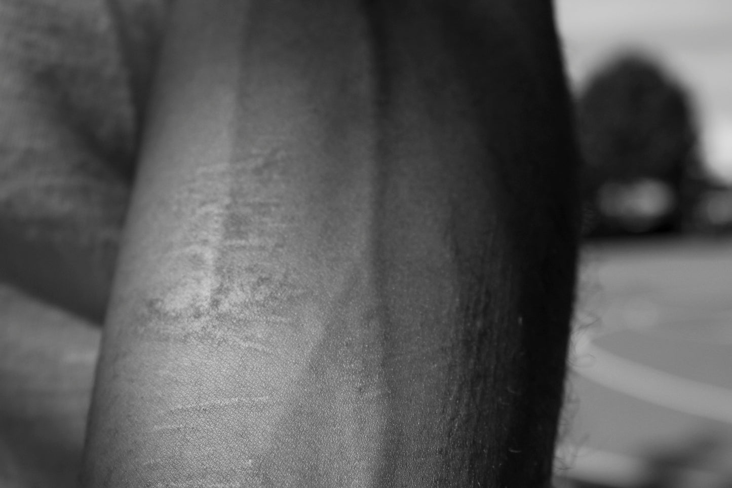 Omar: My Head is a Part of My Body